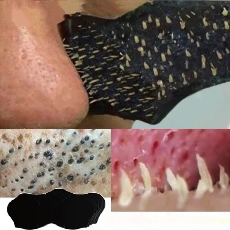 Unisex Blackhead Remove Mask N - Skincare Indonesia incelemesi ve fiyatı