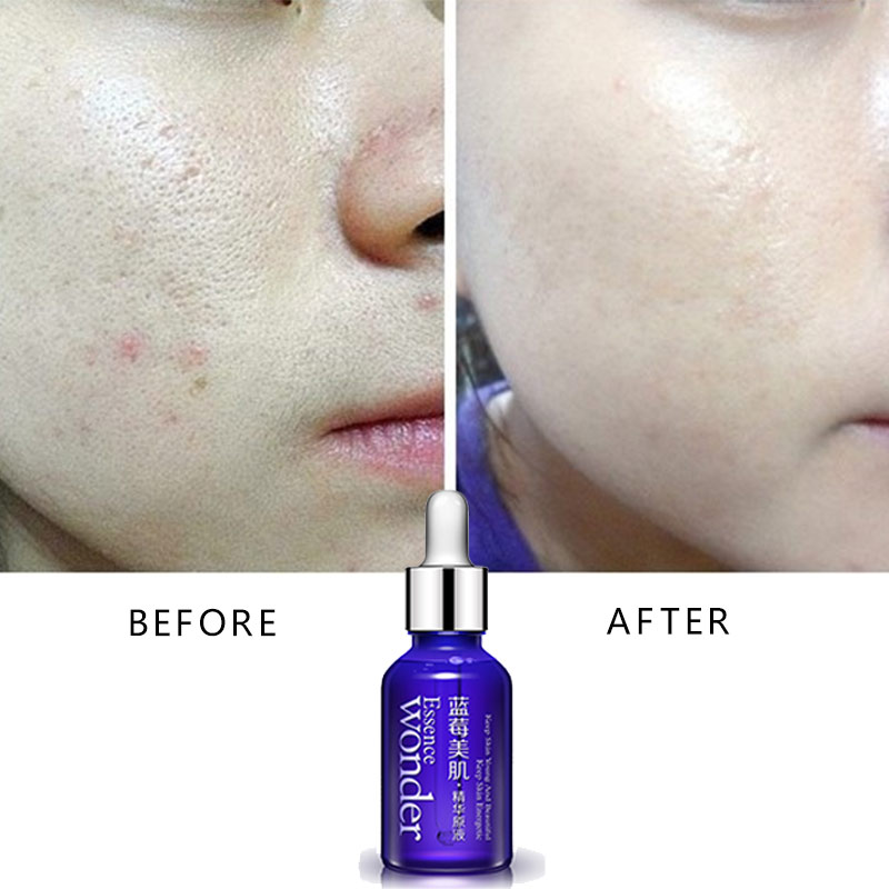 BIOAQUA yabanmersini yüz kaldı - Skincare Garnier incelemesi ve fiyatı