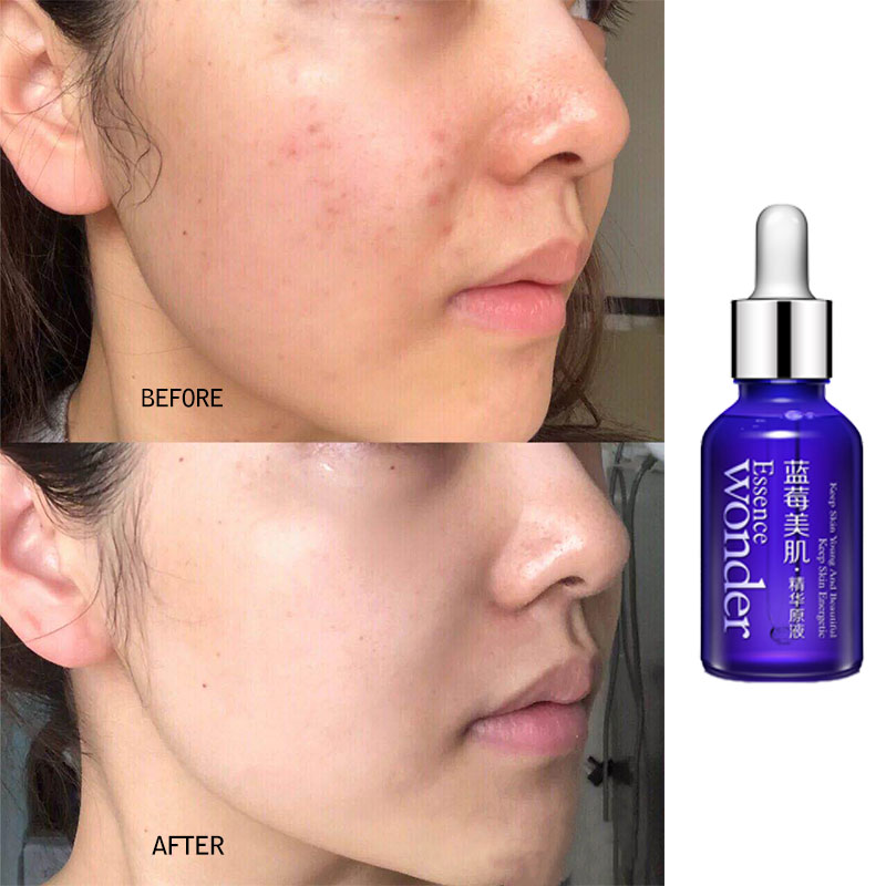BIOAQUA yabanmersini yüz kaldı - Skincare Garnier incelemesi ve fiyatı