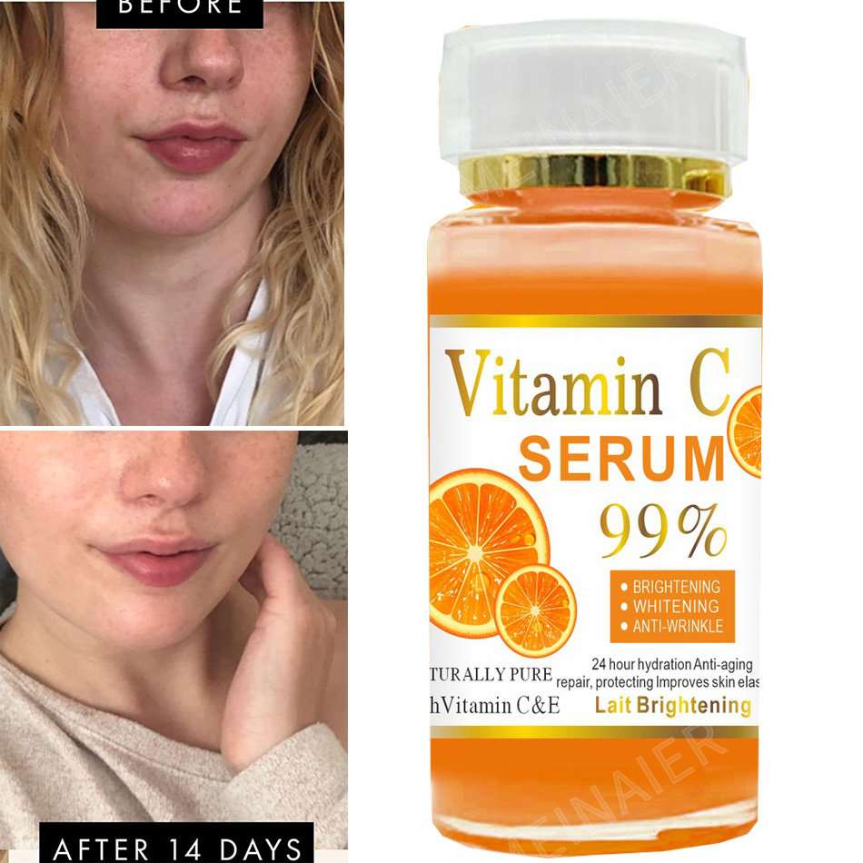 120ml 99% C vitamini Serum yağ - Skincare Garnier incelemesi ve fiyatı