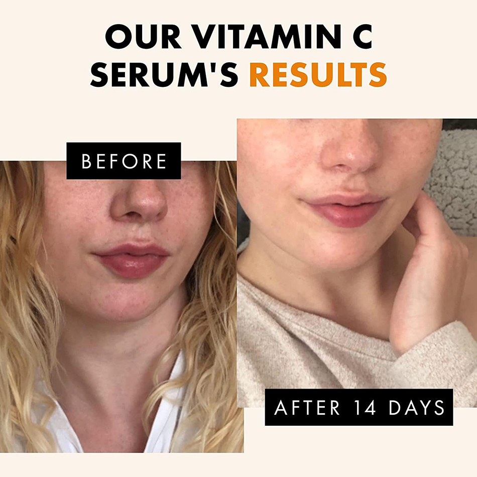 120ml 99% C vitamini Serum yağ - Skincare Garnier incelemesi ve fiyatı