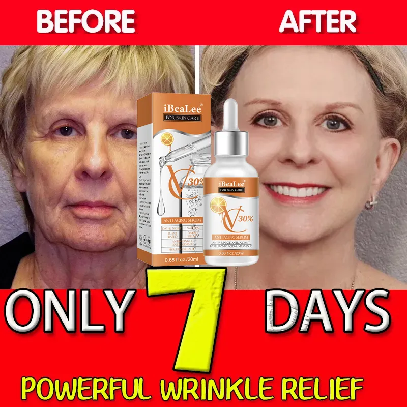 Prim 30% C vitamini Serum yüz  - Skincare Garnier incelemesi ve fiyatı