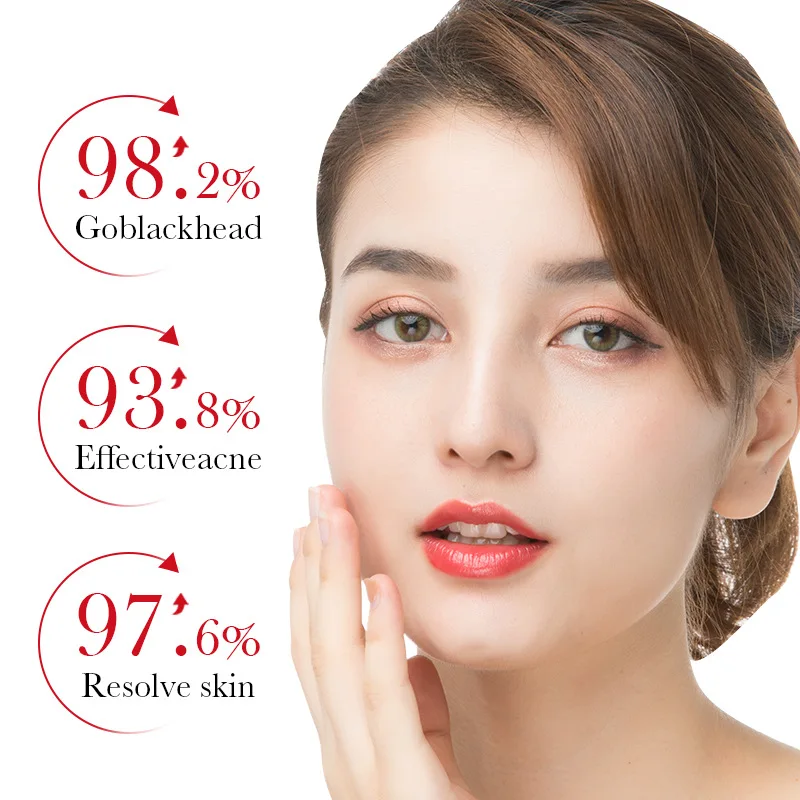 BIOAQUA Salisilik Asit Akne Çı - Skincare Garnier incelemesi ve fiyatı