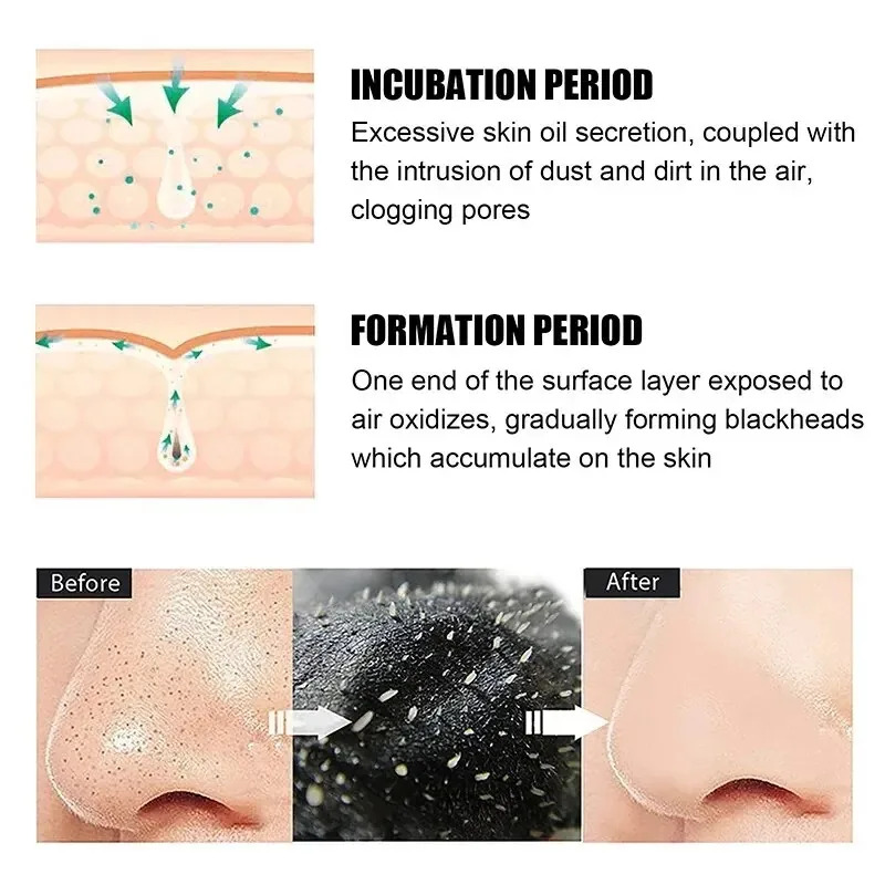 10/150 adet siyah nokta kaldır - Skincare Indonesia incelemesi ve fiyatı